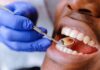 Teeth Cleaning Tips:5 चीजों से दांतो का पीलापन और दुर्गन्ध दूर करे ,किचन में मौजूद चीजों से बनाए मोतियों जैसे चमकदार Teeth Cleaning Tips: गुटखा-तंबाकू खाने से दांत हो गए हैं खराब, तो किचन में मौजूद 3 चीजों से बनाए मोतियों जैसे चमकदार
